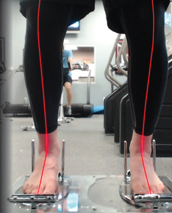 Legs aligned on laser alignment panel